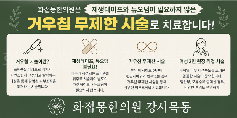 여자 전신 편평사마귀 무제한 거우침 제거 후기 [1000개 무제한]