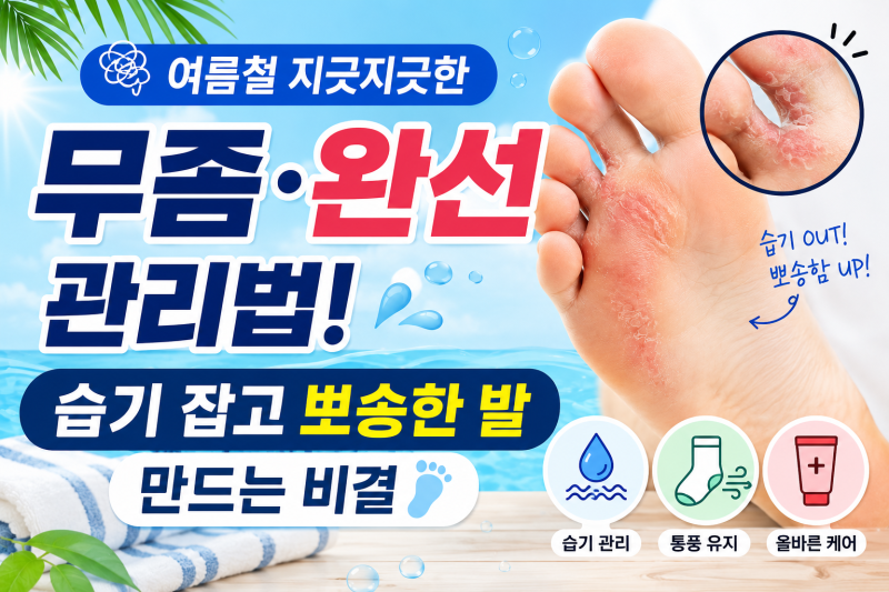 여름철 지긋지긋한 무좀·완선 관리법! 습기 잡고 뽀송한 발 만드는 비결