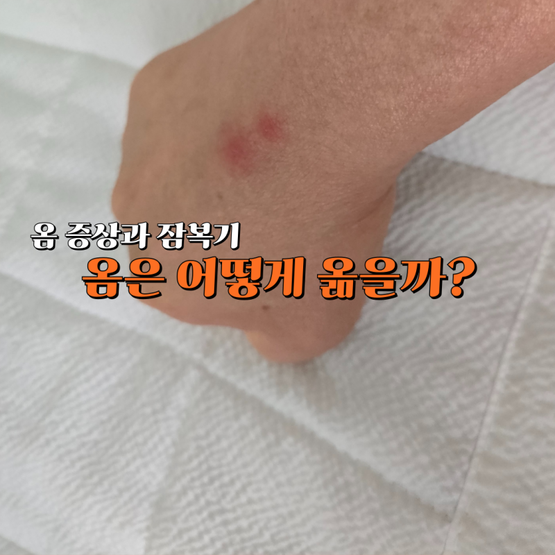 옴은 어떻게 옮을까? 대표 옴 증상과 잠복기 정리