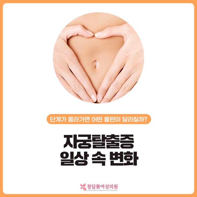 자궁탈출증 단계가 올라가면 어떤 불편이 달라질까요 | 일상 속 변화 정리