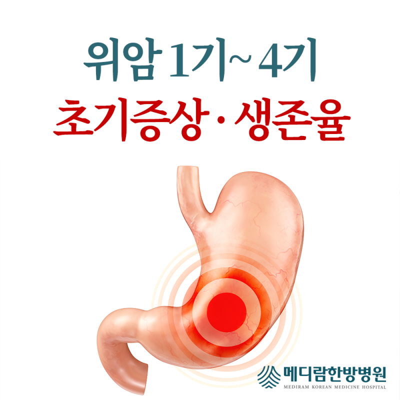 위암 1기 2기 3기 4기 초기증상과 생존율
