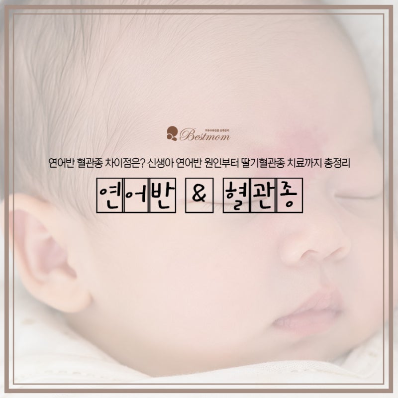 연어반 혈관종 차이점은? 신생아 연어반 원인부터 딸기혈관종 치료까지 총정리
