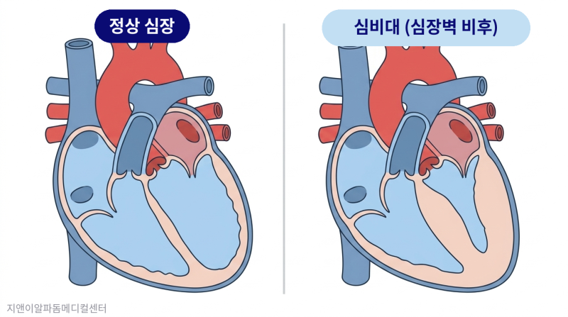 심장혈관 검사, 종류별 차이와 나에게 맞는 검사 가이드