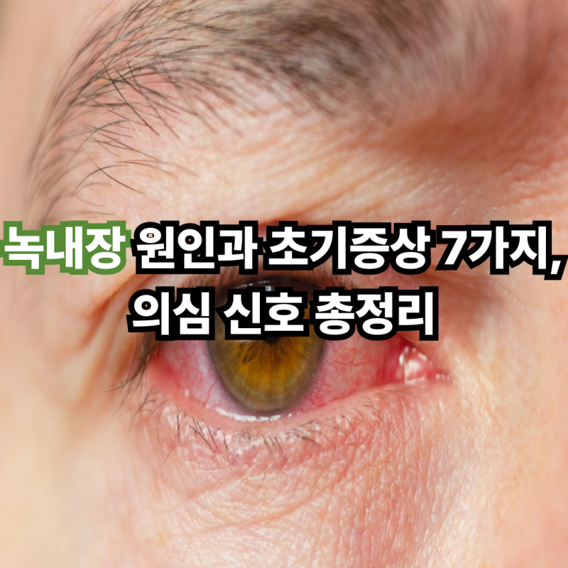 녹내장 원인과 초기증상 7가지, 의심 신호 총정리