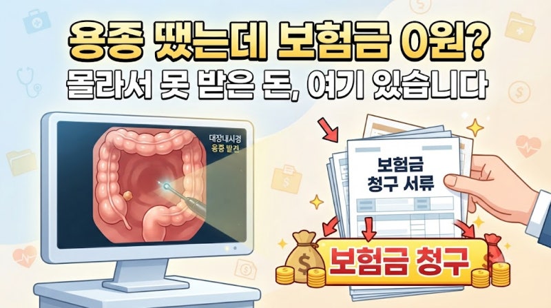 대장 용종 떼고 "검사비"만 내셨다고요? 지금 못 받은 보험금이 최대 세 갈래로 새고 있습니....