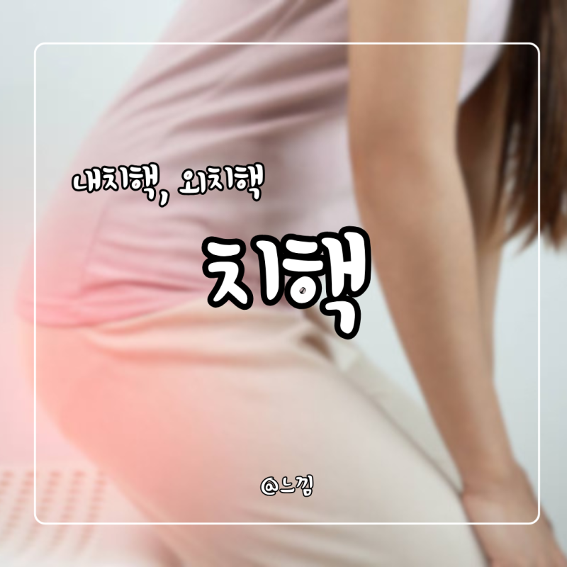내치핵 외치핵 증상 원인 치핵 증상 자연치료