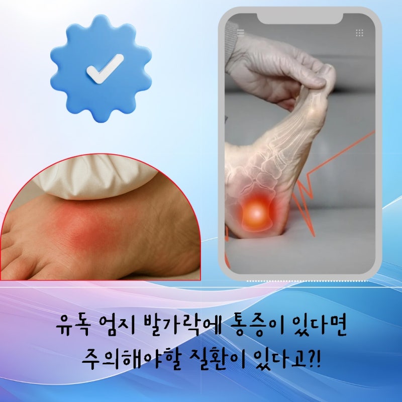 이유 없이 아픈 오른쪽발등통증 통풍 증상일까요