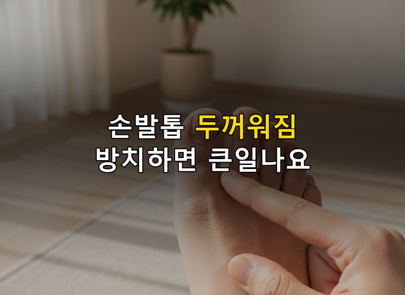 손발톱무좀 손톱이 자꾸 두꺼워진다면 꼭 읽어보세요