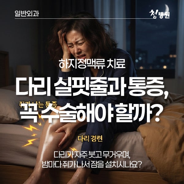 다리 실핏줄과 통증, 꼭 수술해야 할까?: 하지정맥류 치료법