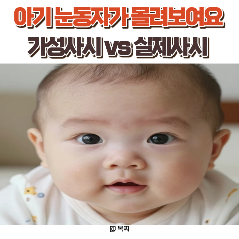 아기 눈동자가 몰려 보여요! 가성 사시와 실제 사시 차이 총정리