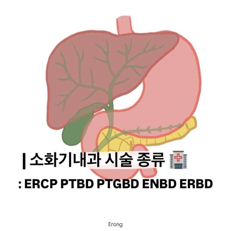 [간호]소화기내과 시술 종류, ERCP, PTBD, PTGBD, ENBD, ERBD | 차이, 시술방법 | 간호대학생, 신규간호....