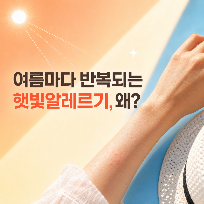 햇빛알레르기 증상 왜 여름마다 심해질까요?