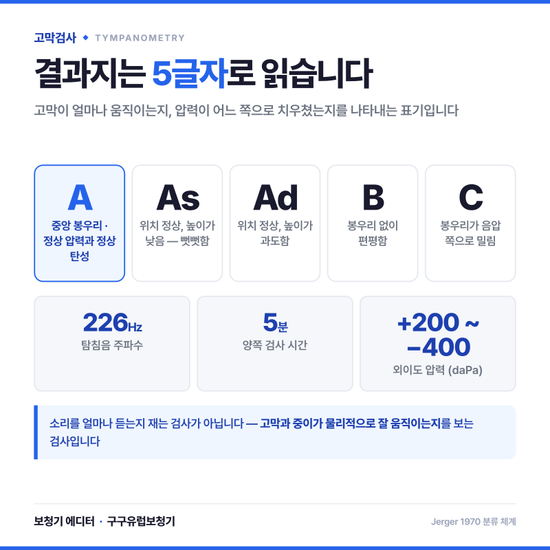 고막검사 결과 보는 법, 임피던스 청력검사 완전정리