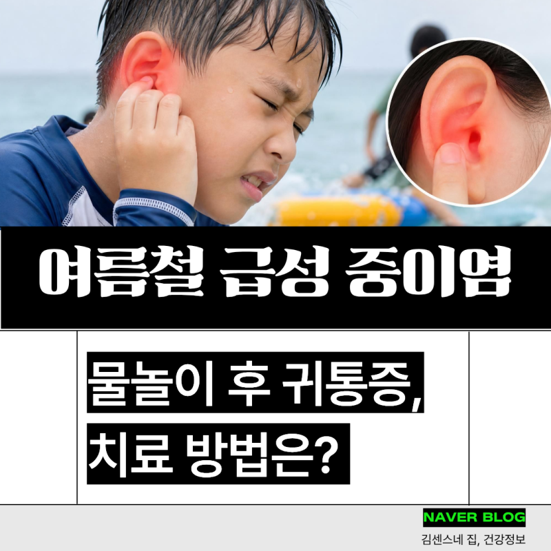 여름철 급성 중이염 증상 물놀이 후 귀통증 치료 방법은?
