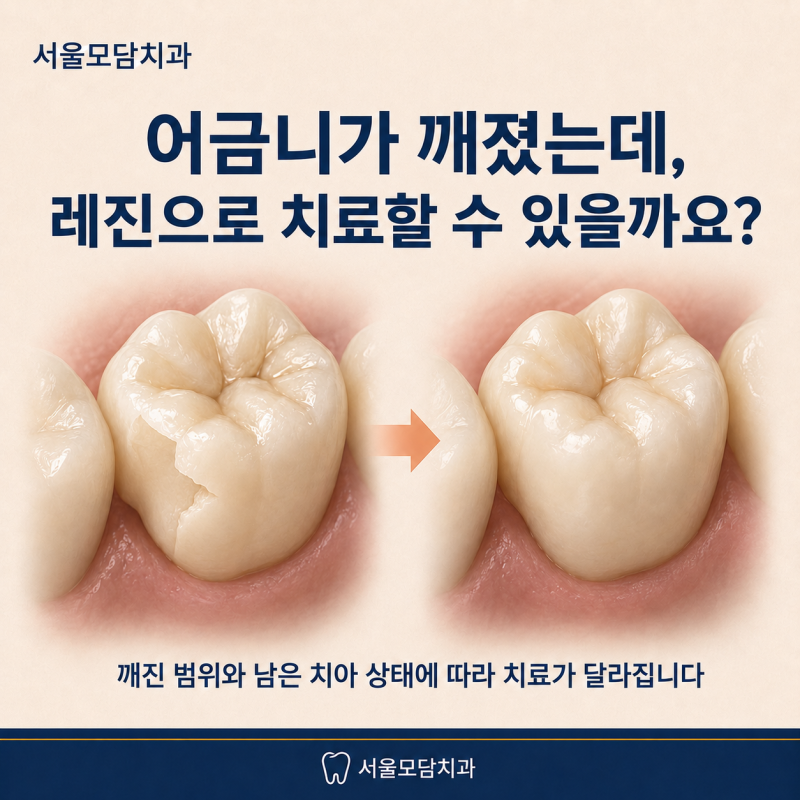어금니가 깨졌는데, 레진으로 치료할 수 있을까요?