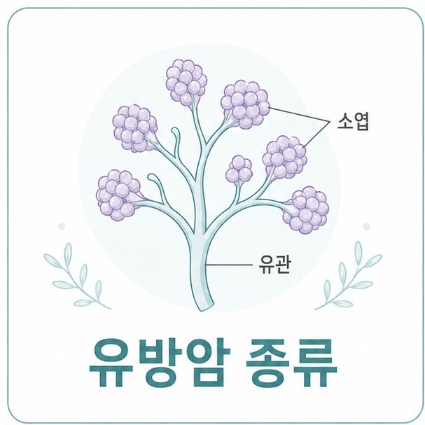 유방암 종류와 침윤 여부, 아형 구분 정리
