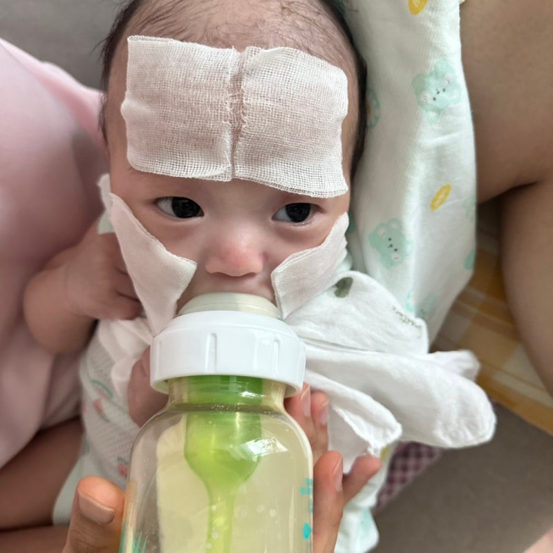 아기 지루성 두피염, 태열 자가 치료 (무스텔라 오일, 무스텔라 뉴본샴푸, 약모밀앰플, 바이....