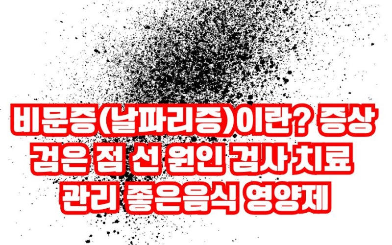 비문증(날파리증)이란? 즉시 안과 진료 증상 원인 검사 치료 관리 좋은음식 영양제