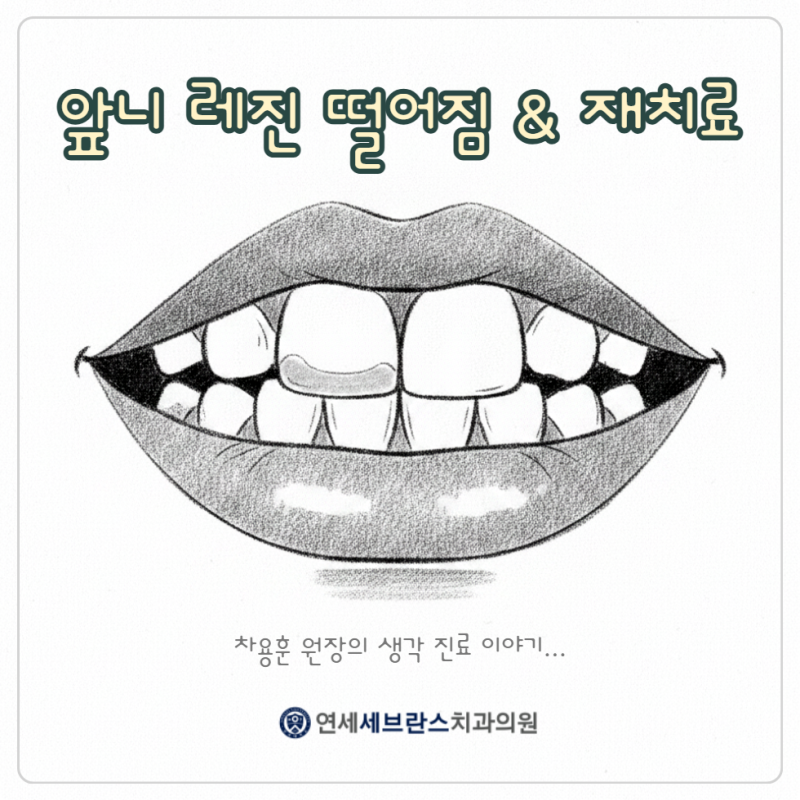 앞니 레진 떨어짐 - 치료 시 비용은 얼마 드나요?