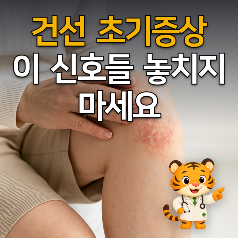 건선 초기증상, 이 신호들 놓치지 마세요