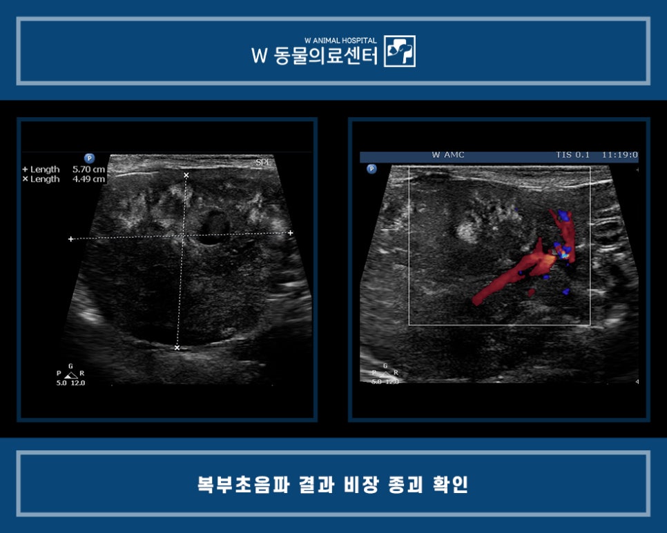 비장 사진 4
