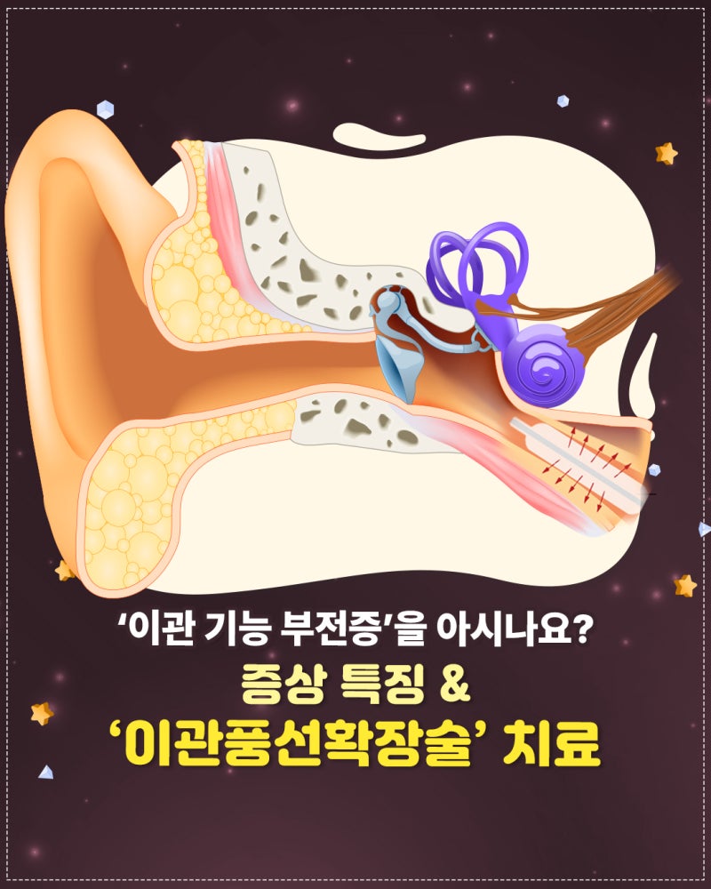 이관 기능 부전증이란?
