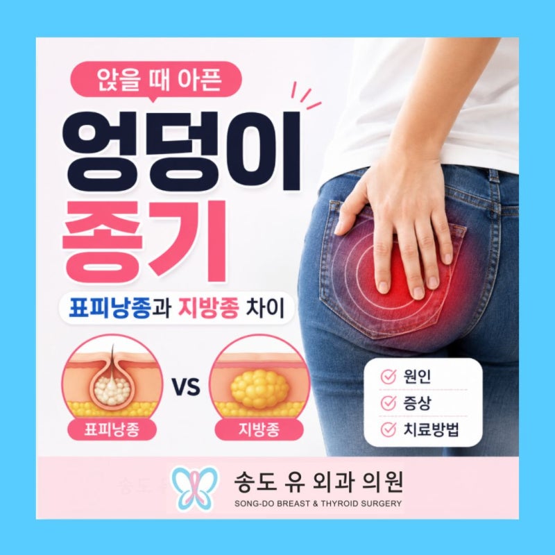앉을 때 아픈 엉덩이 종기, 표피낭종과 지방종 차이