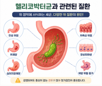 헬리코박터균 양성이면 꼭 치료해야 할까?