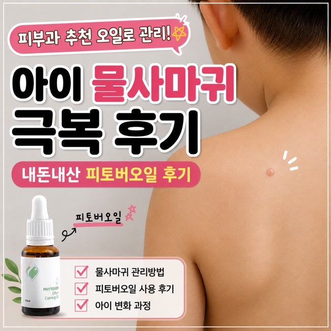 아이 물사마귀 생겼을 때 대처 방법 | 9살 아이 치료 과정과 관리 기록
