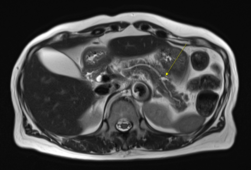 MRI 3.0T 1.5T 차이, 비교할 때 확인할 기준
