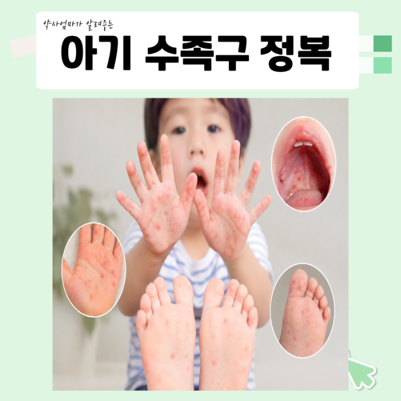 아기 수족구 증상부터 회복까지ㅣ약사엄마 관리법ㆍ상비약 리스트