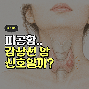 갑상선암 초기 증상 이유 없는 피곤함?