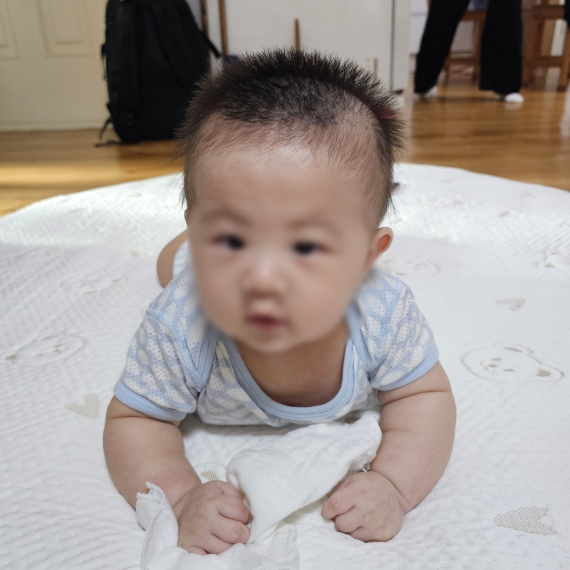 아기 손등 수포 뾰루지 오돌토돌 땀띠 습진 물집 비판텐 써도될까