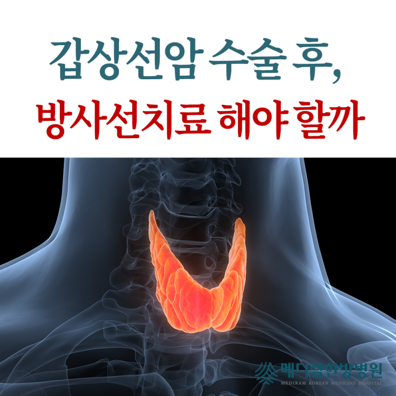갑상선암 수술 후 방사선치료, 왜 필요할까요?