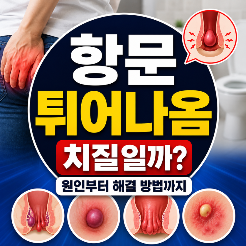 항문 튀어나옴, 치질일까? 원인부터 해결 방법까지