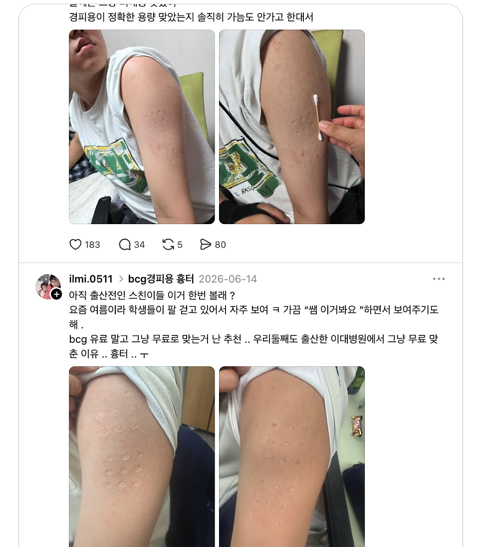 우아 사진 2