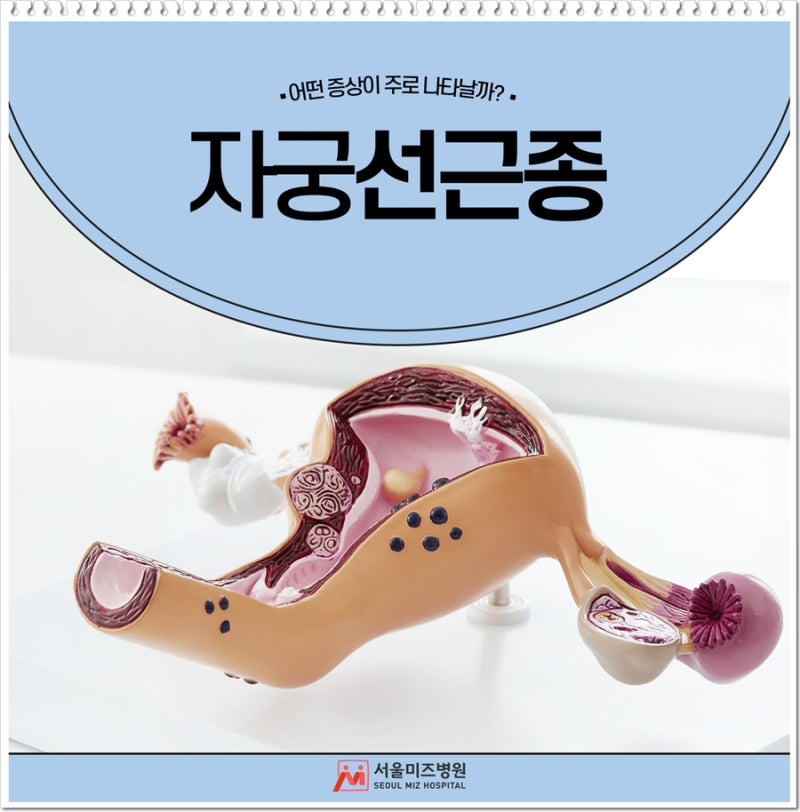 자궁선근종 원인 증상 자궁근종과는 뭐가 다를까요