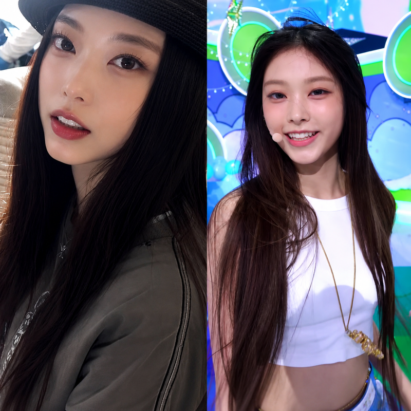 뉴진스 해린 치아 변화, 라미네이트 말 나오는 이유
