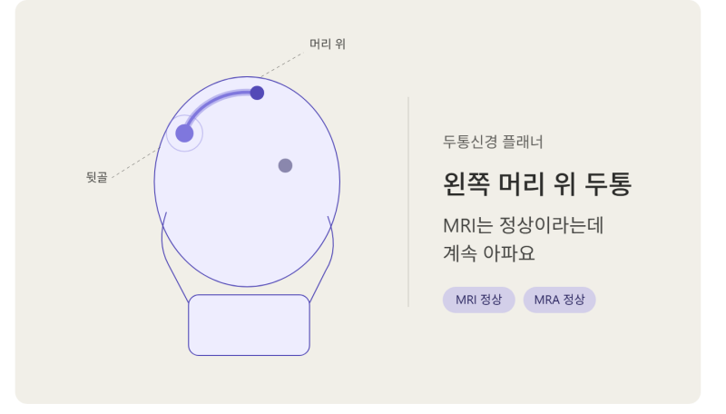 왼쪽 머리 위 두통 원인 MRI는 정상이라는데 계속 아파요