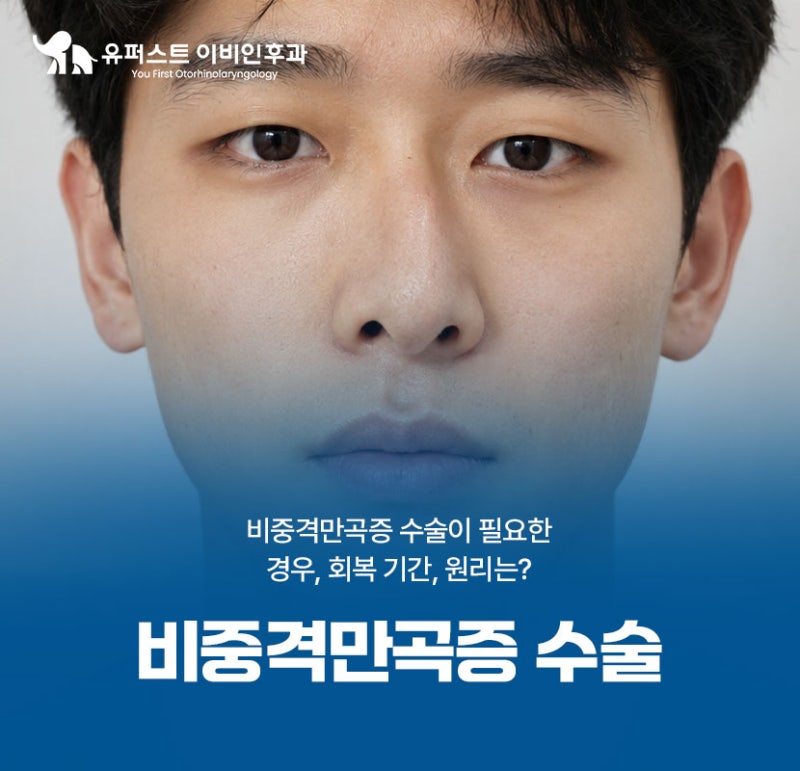 비중격만곡증수술 필요한 경우, 회복 기간, 원리 알아보기