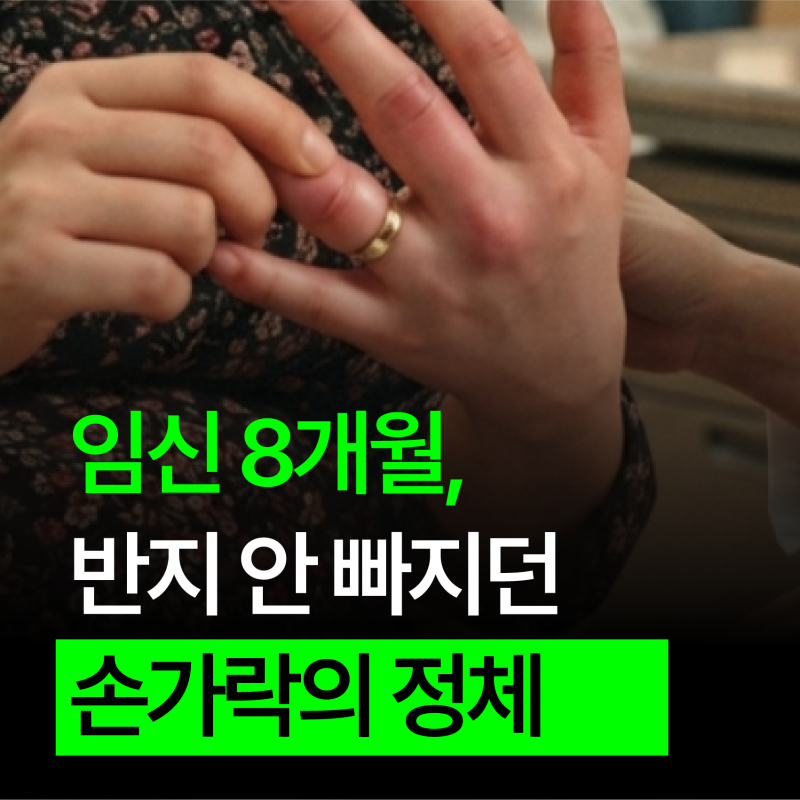 임신중독증 증상과 원인, 임신 20주 이후 꼭 알아야 할 것들