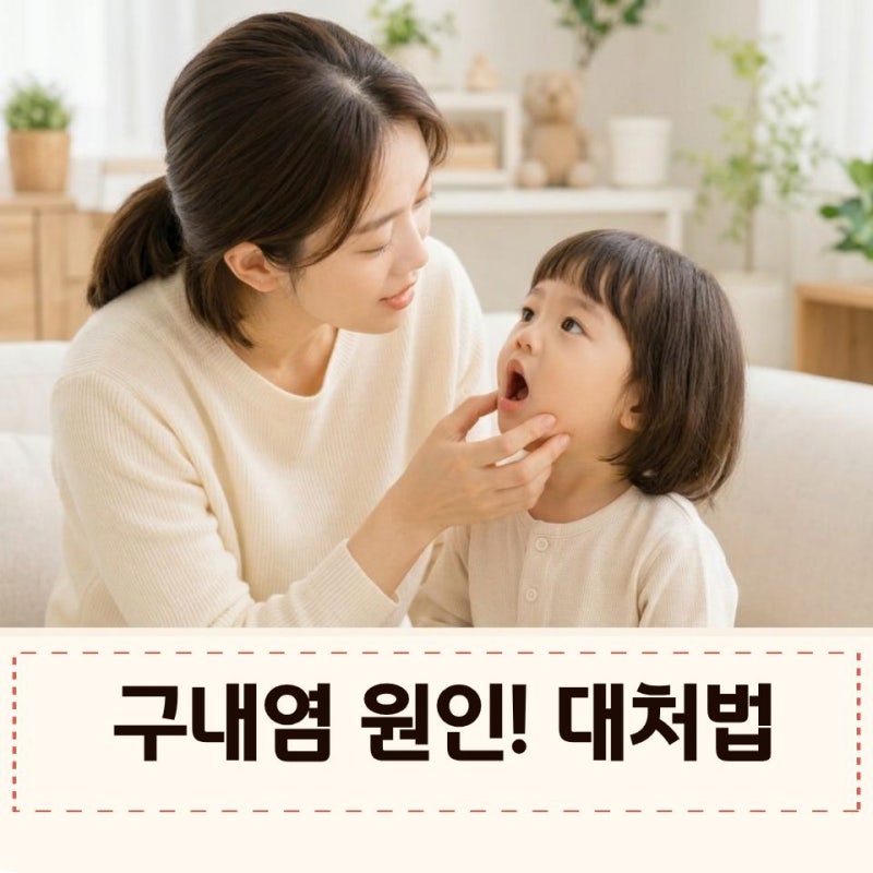 아기 구내염 원인과 초기 증상, 수족구 차이점부터 전염 기간까지 총정리