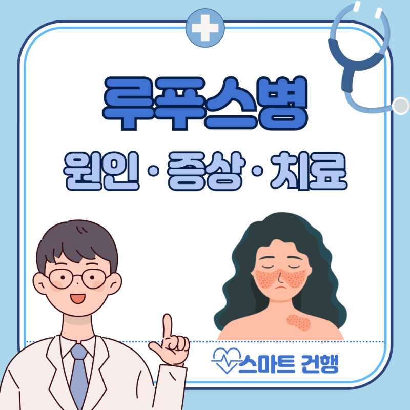 루푸스 증상, 홍반, 루푸스병 완치 가능? 치료법