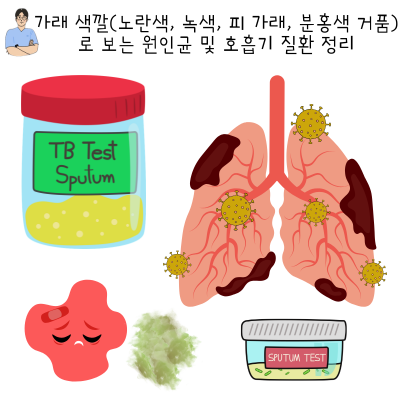 가래 색깔(노란색, 녹색, 피 가래, 분홍색 거품)로 보는 원인균 및 호흡기 질환 정리