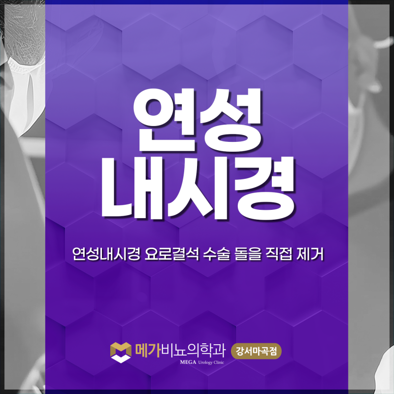 연성내시경 요로결석수술 돌을 직접 제거하면 좋은 점