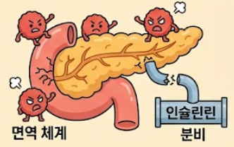 제1형 vs 제2형 당뇨병 총정리 원인 치료법 음식