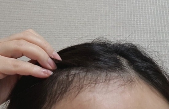 홍현희샴푸 바이브랩 초록샴푸 후기
