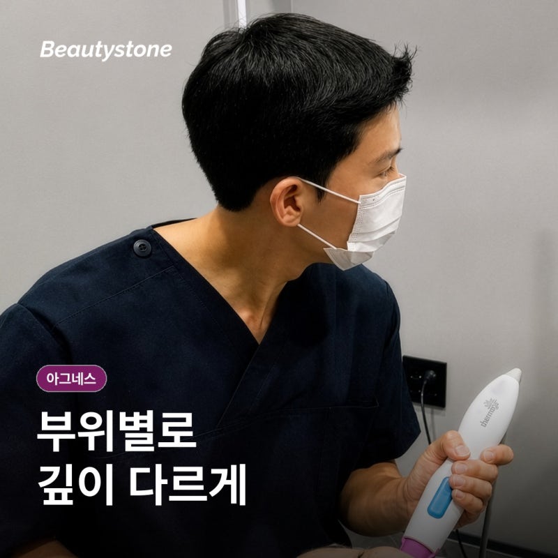 아그네스 시술 원리와 통증, 회복 기간까지 알아보기