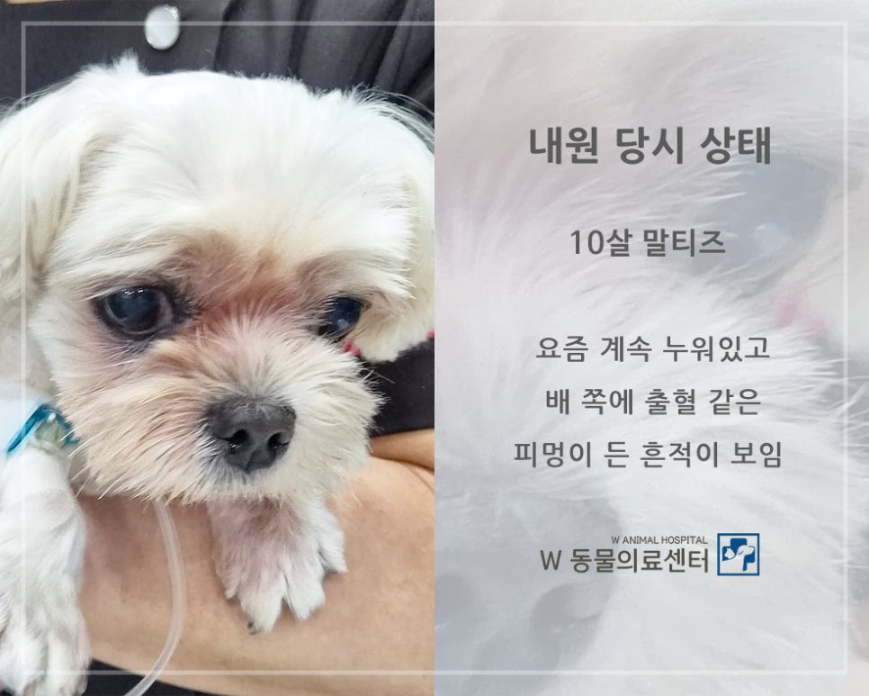 비장 사진 2