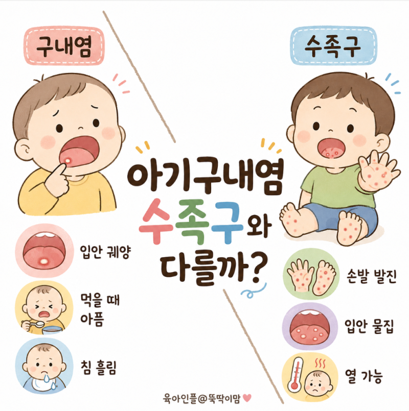 아기구내염 수족구와 다를까? 열과 입안 물집 확인하기